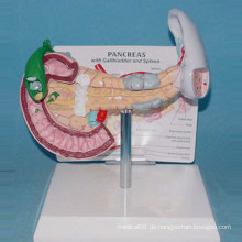 Medizinische Gallensteine ​​und Milz und Bauchspeicheldrüse Anatomisches Modell (R100207)